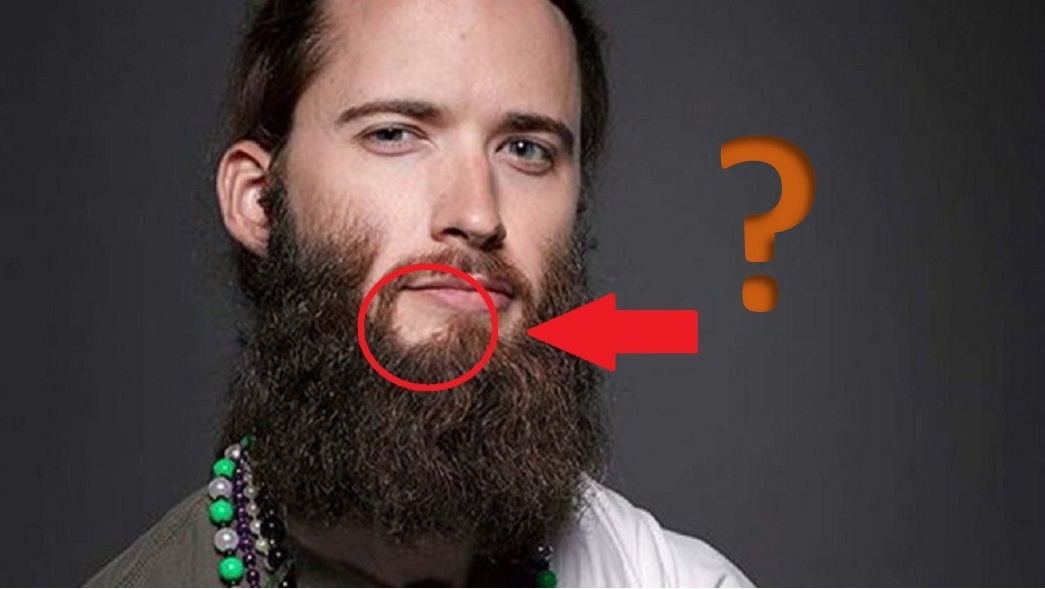 no funciona minoxidil barba